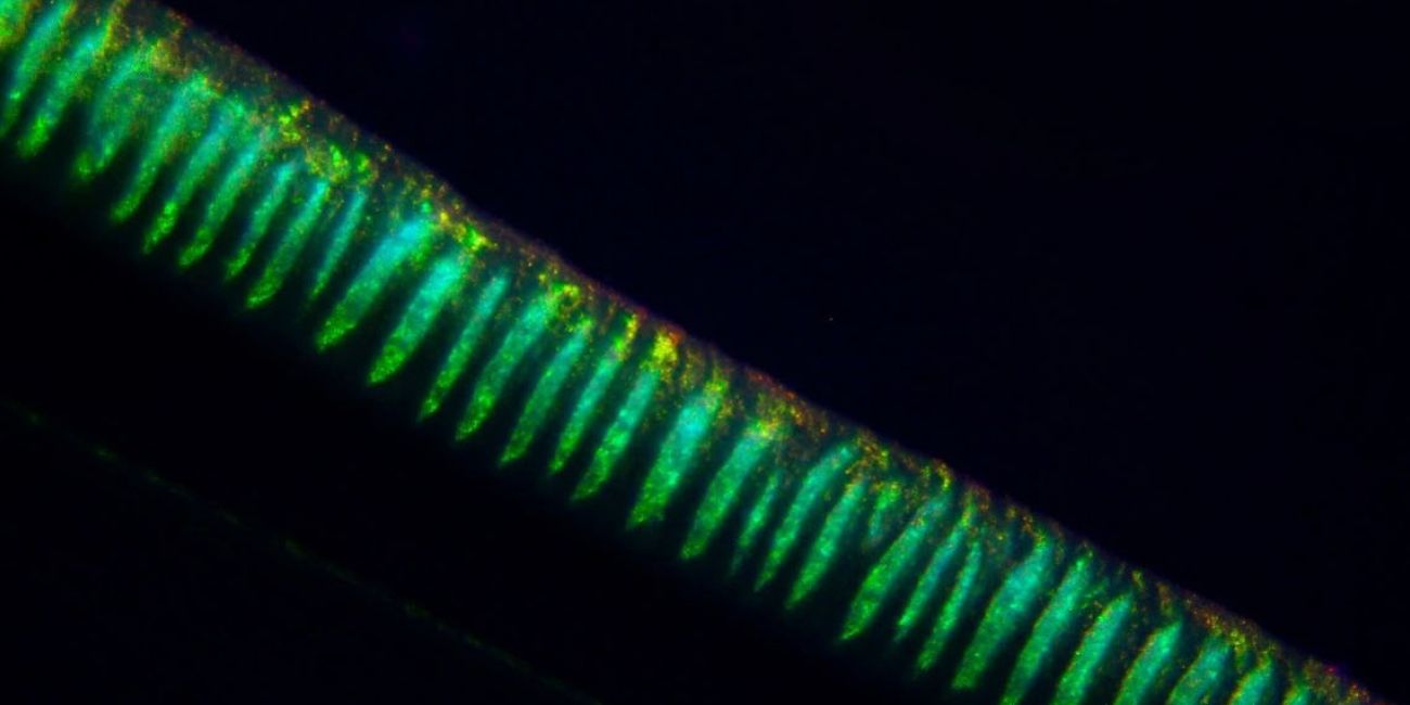 Hoekmine. Finding the genes that colour life in the sea